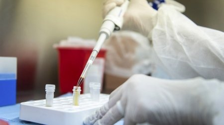 Investigadores avanzan en contrarrestar la resistencia a un tratamiento de melanoma