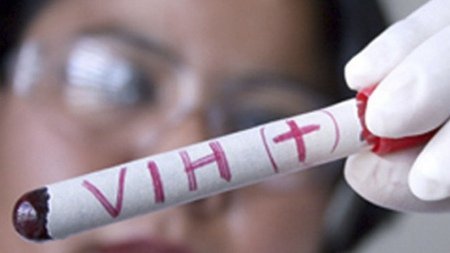 Tercer caso en el mundo de cura del VIH tras un trasplante de células madre